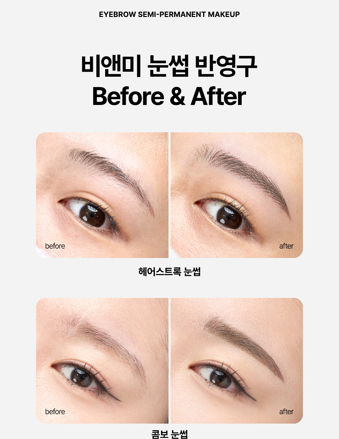 반영구 눈썹 시술 압구정 비앤미의원