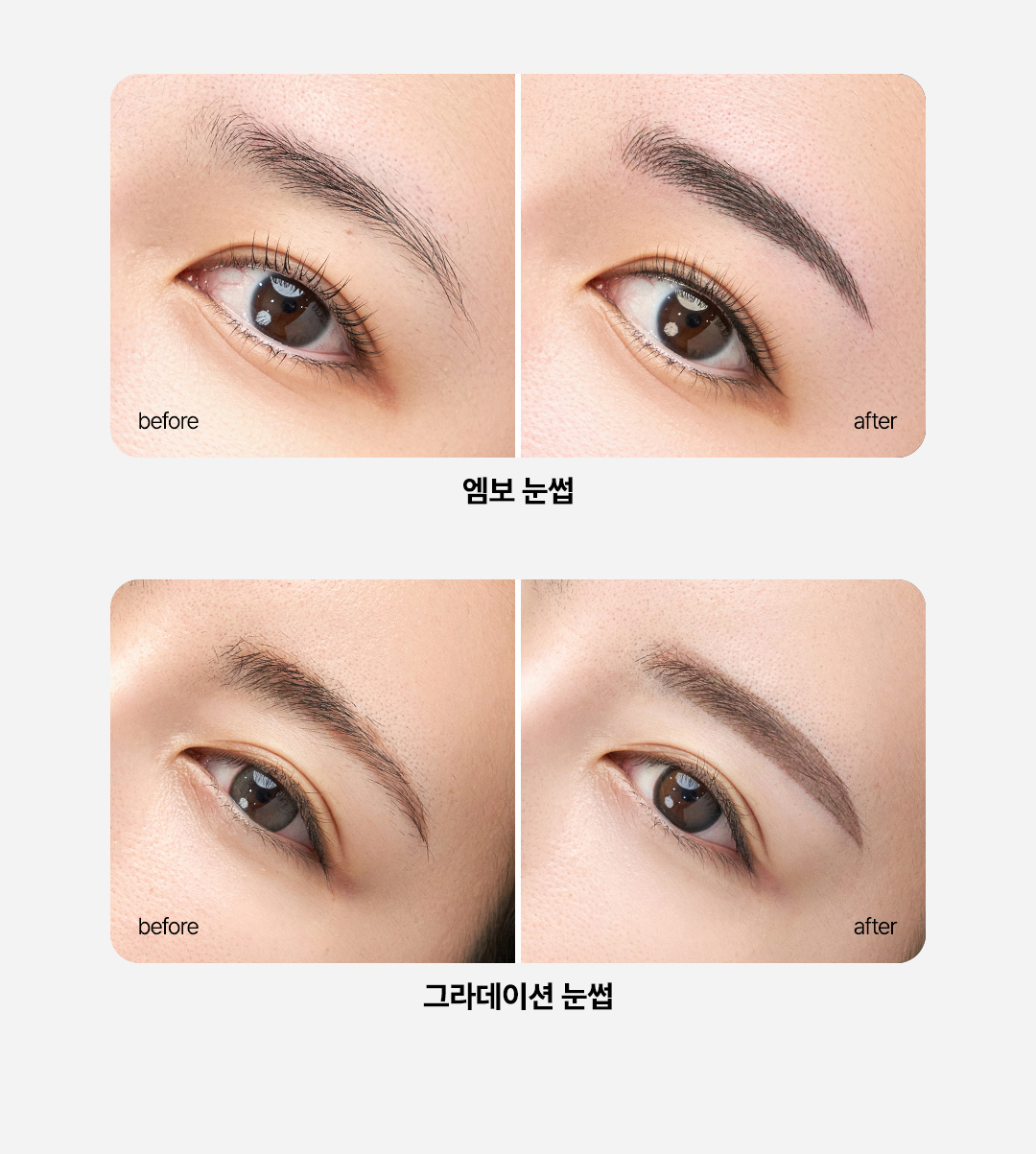 반영구 눈썹 시술 압구정 비앤미의원