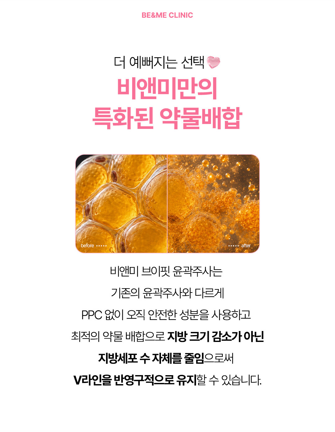 압구정 비앤미 브이핏 윤곽주사 지방세포 분해 원리 및 안전한 성분