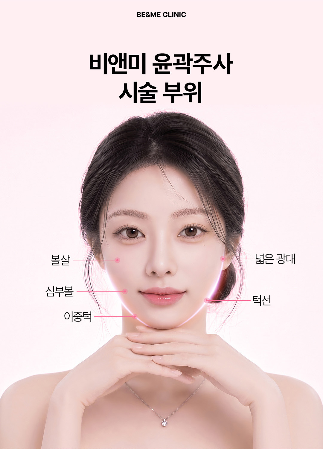 윤곽주사 시술 부위 안내 광대살 심부볼 볼살 이중턱 턱선 윤곽주사 압구정비앤미