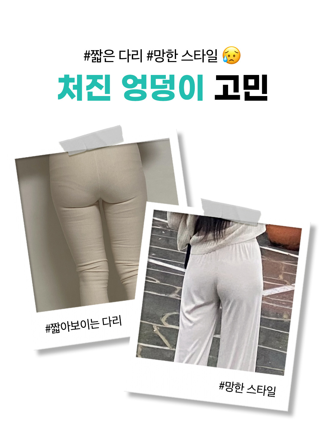 압구정성형외과 처진 엉덩이 리프팅 고민 비앤미 힙업벨로디2