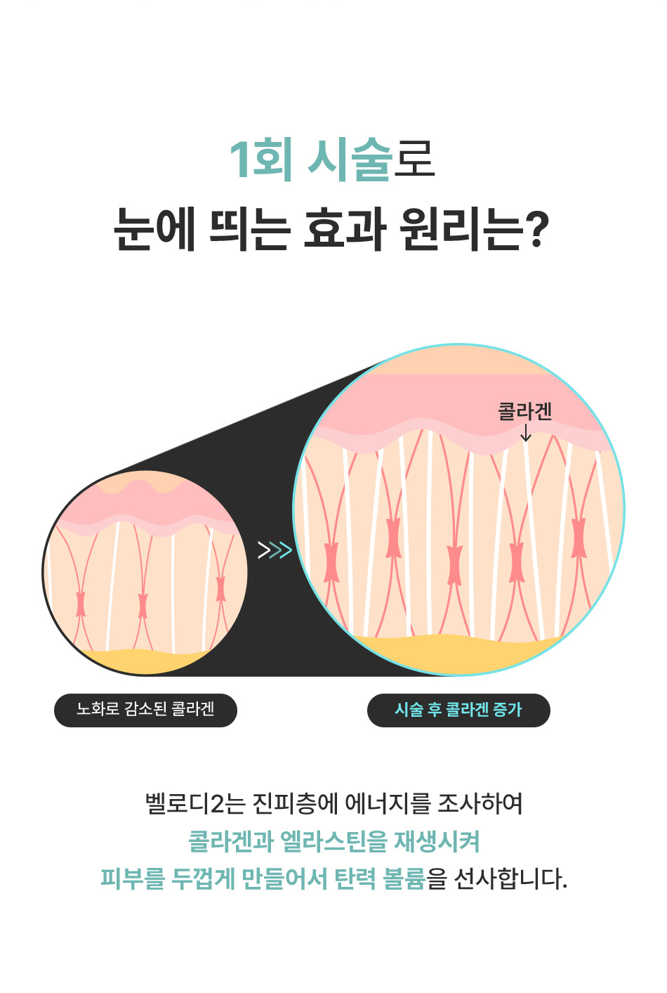 바디벨로디2 원리 콜라겐 및 엘라스틴 재생으로 진피층 탄력 개선 비앤미