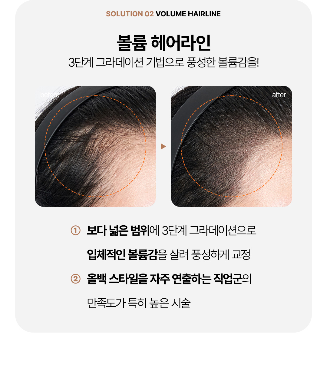 헤어라인반영구 유지기간 및 선명함이 오래가는 비앤미 노하우