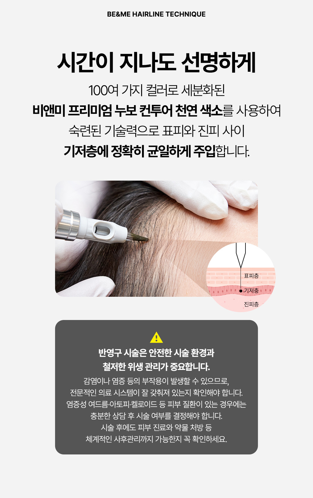 강남 압구정 헤어라인반영구 가격 혜택 및 헤어라인문신 비용