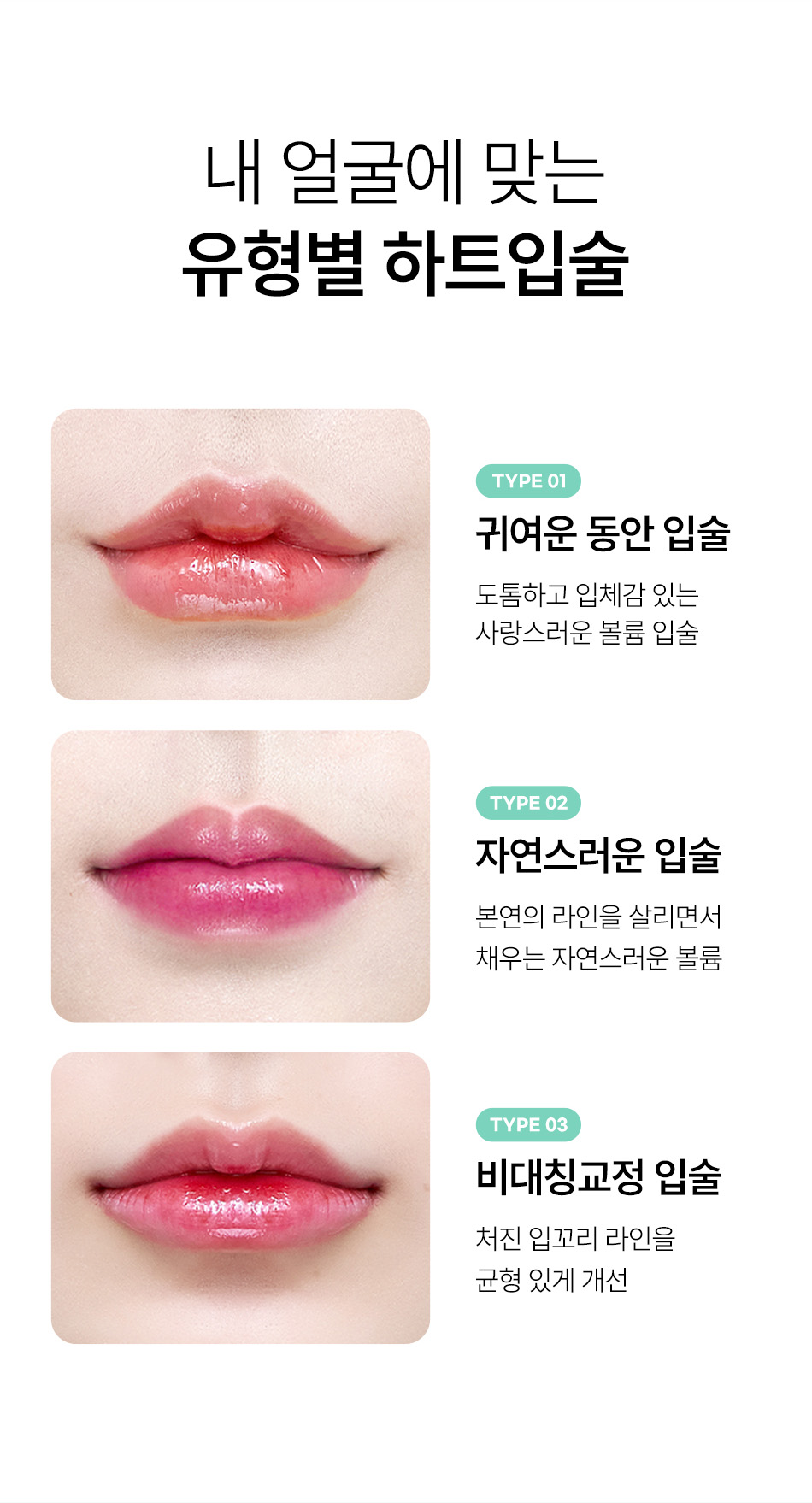 유형별 맞춤 입술필러 얇은 입술 볼륨 채우기 및 비대칭 입술 모양 교정