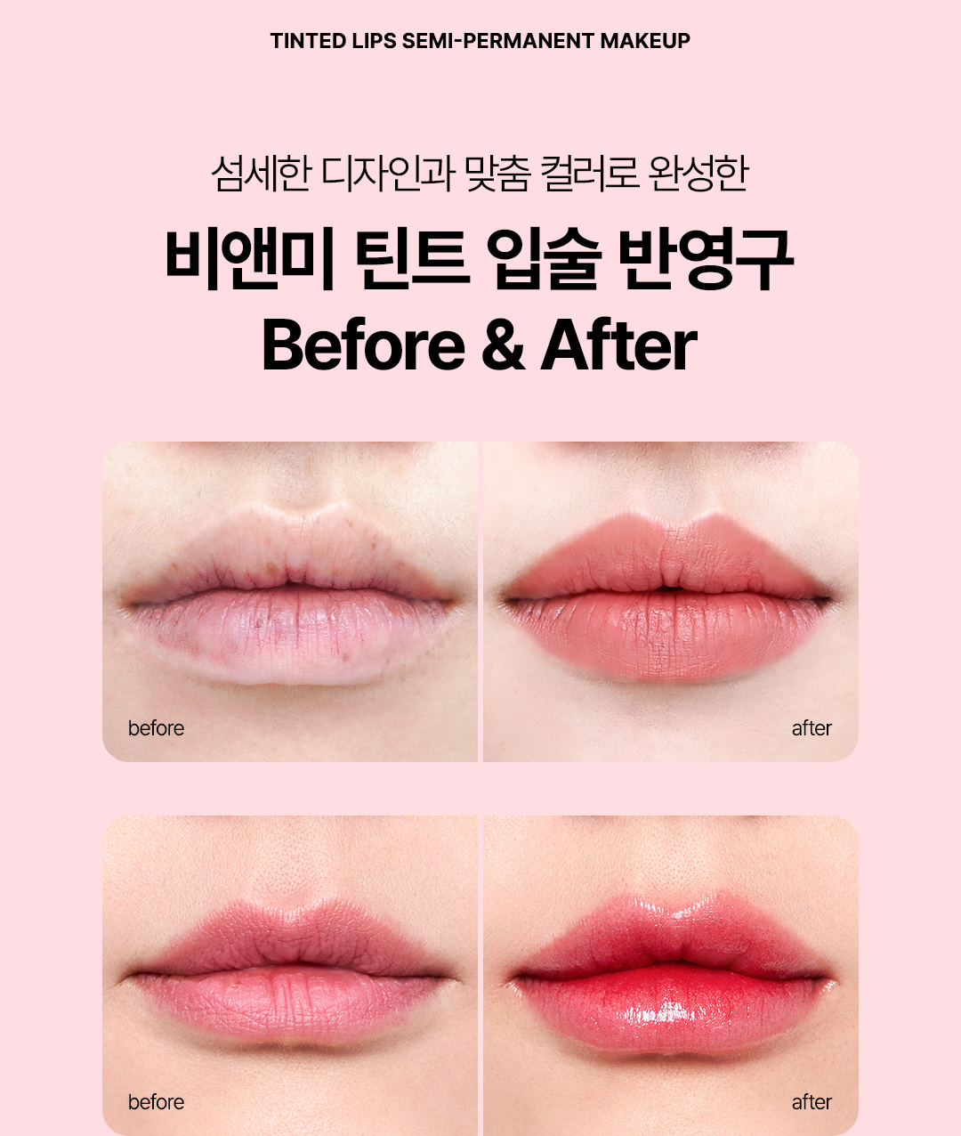 세계적인 반영구 그룹 비앤미의원 입술반영구 대표 의료진 및 기술력