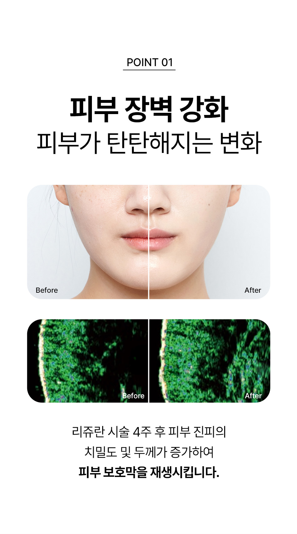 리쥬란힐러