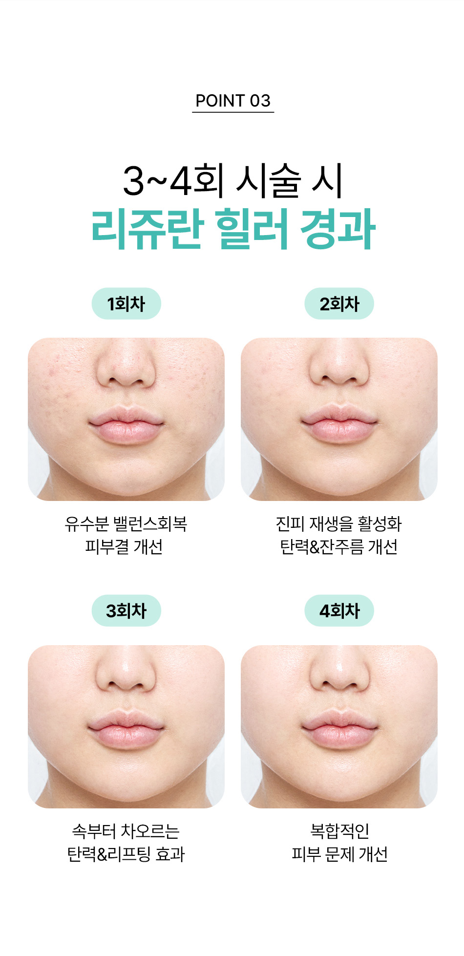 리쥬란힐러
