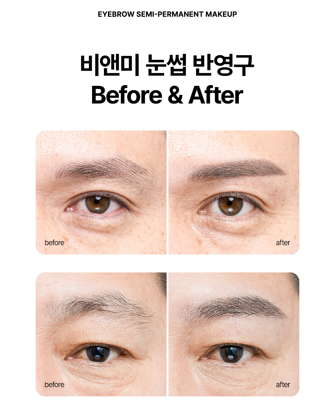 남자눈썹문신 전후 비교 비앤미 남자눈썹반영구 비포애프터 후기