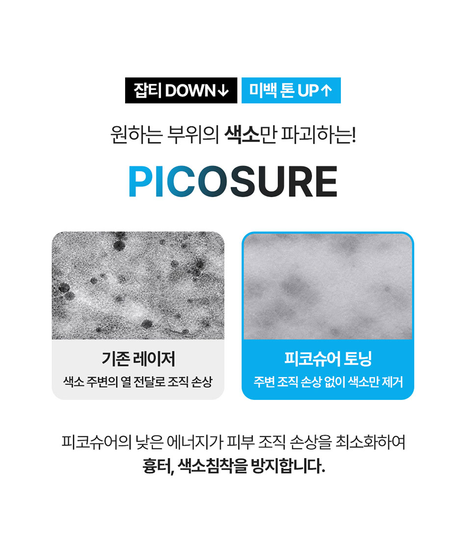 피코슈어토닝 2
