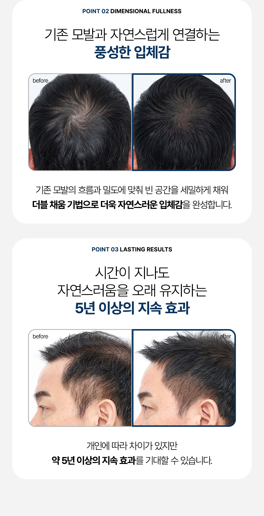 선명하고 또렷한 밀도 보강 압구정 비앤미 두피문신 노하우