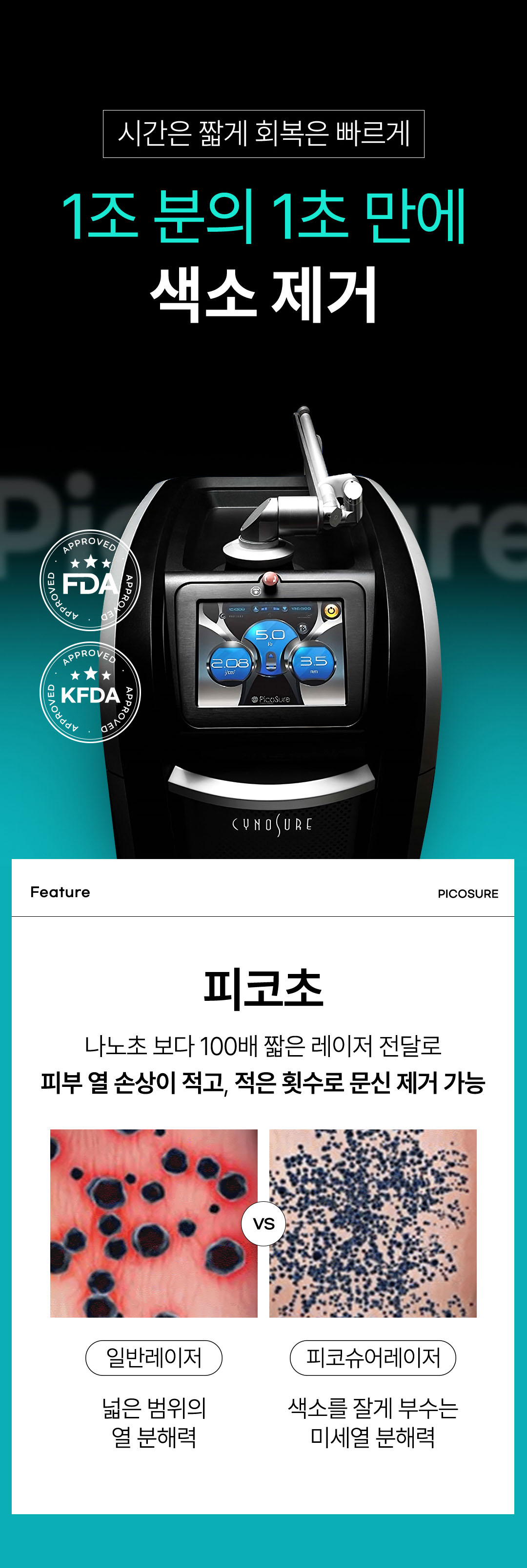 아이라인 반영구 문신 제거 통증 적고 안전한 시술 비앤미