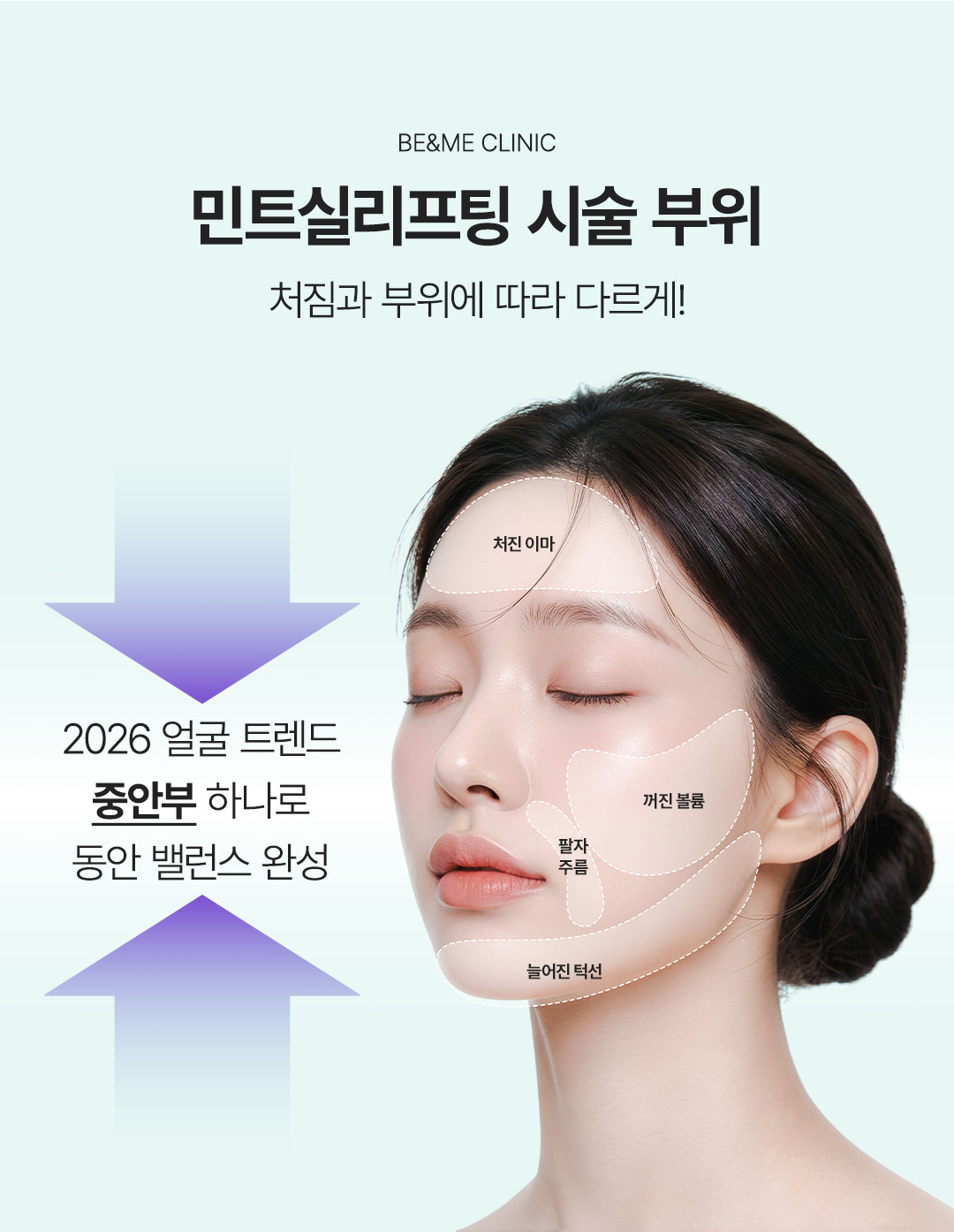 압구정 비앤미의원 얼굴실리프팅 실리프팅멍 실리프팅비용 실리프팅후기 민트실리프팅 8줄 민트실리프팅 통증 민트실리프팅 붓기 실리프팅 효과 강남실리프팅 추천 강남실리프팅 잘하는 곳 강남실리프팅 이벤트 강남실리프팅 잘하는 병원 민트실리프팅 추천 시술 부위 이중턱 심부볼 팔자주름 V라인