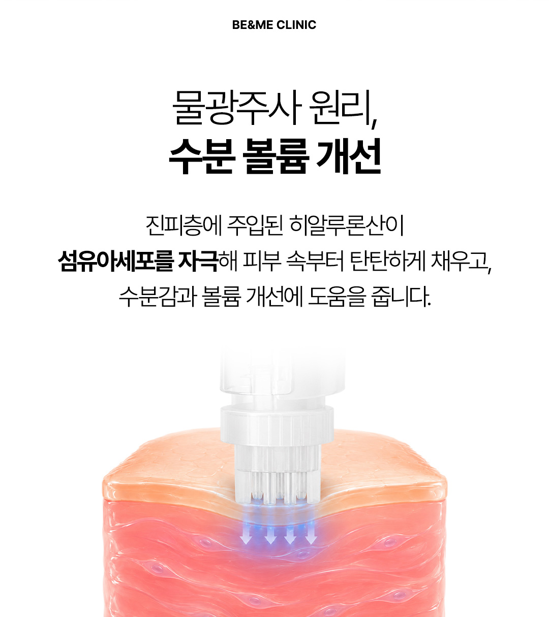 물광주사, 수분주사, 물광주사후기, 물광주사효과, 물광주사통증, 물광주사가격, 물광주사내돈내산, 물광주사엠보, 강남물광주사