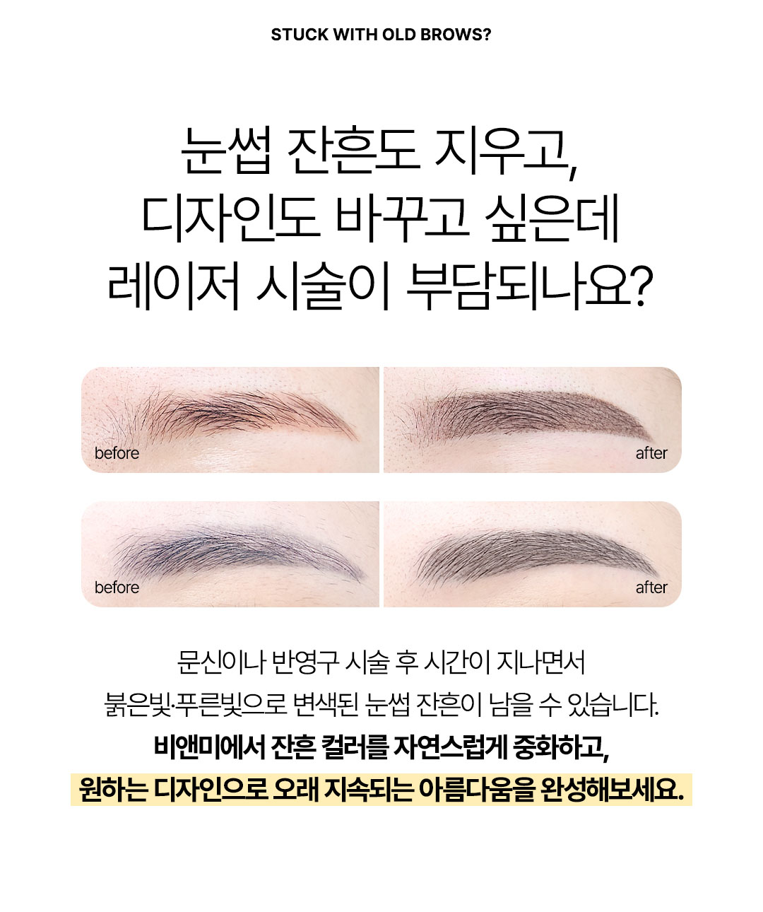 망한 눈썹문신 잔흔제거 커버업 반영구 눈썹 재시술 비앤미