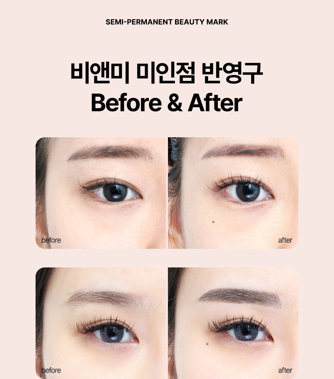 압구정 반영구 미인점 잘하는곳 자연스러운 매력점