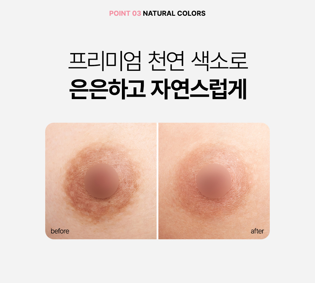압구정 윤륜 반영구 자연스러운 색감 복구 가슴 수술 흉터 커버업 비앤미의원