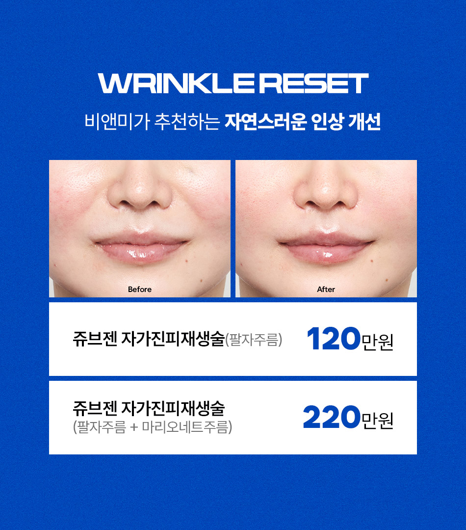 비앤미의원 7월 성형 이벤트 프로그램 전체 안내