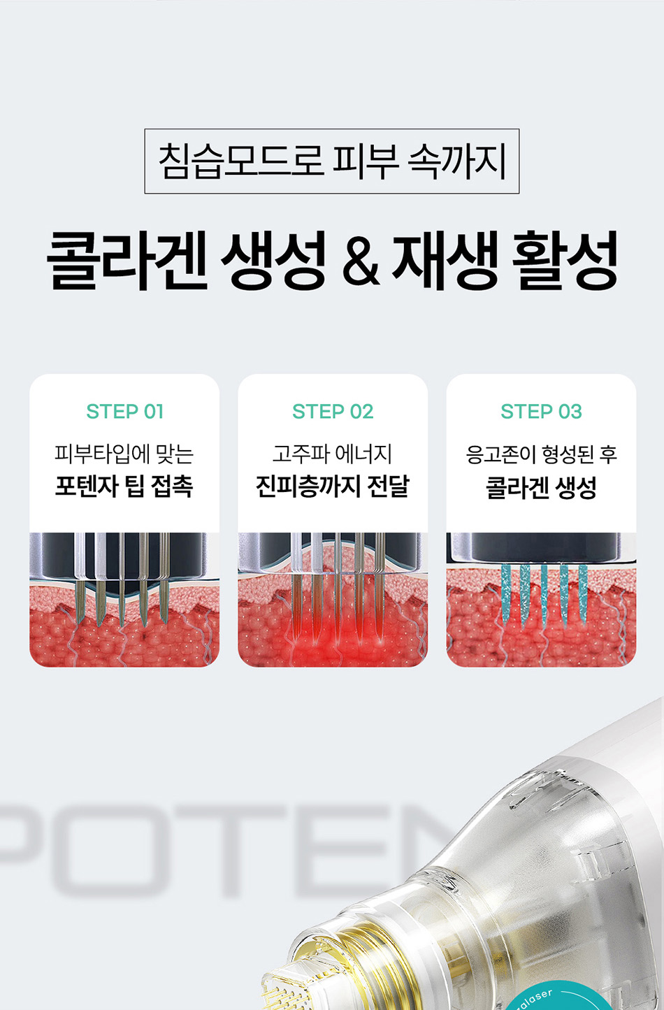 압구정 비앤미의원 포텐자 레이저 시술