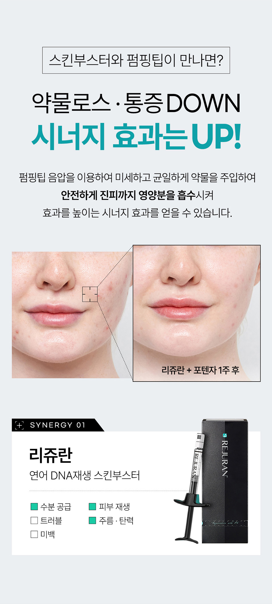 압구정 비앤미의원 포텐자 레이저 시술