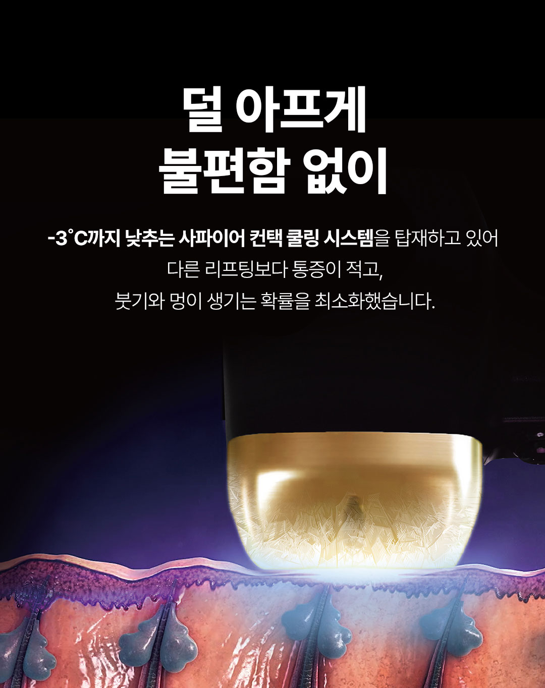 압구정 티타늄 리프팅 통증 적고 빠른 리프팅 잘하는곳