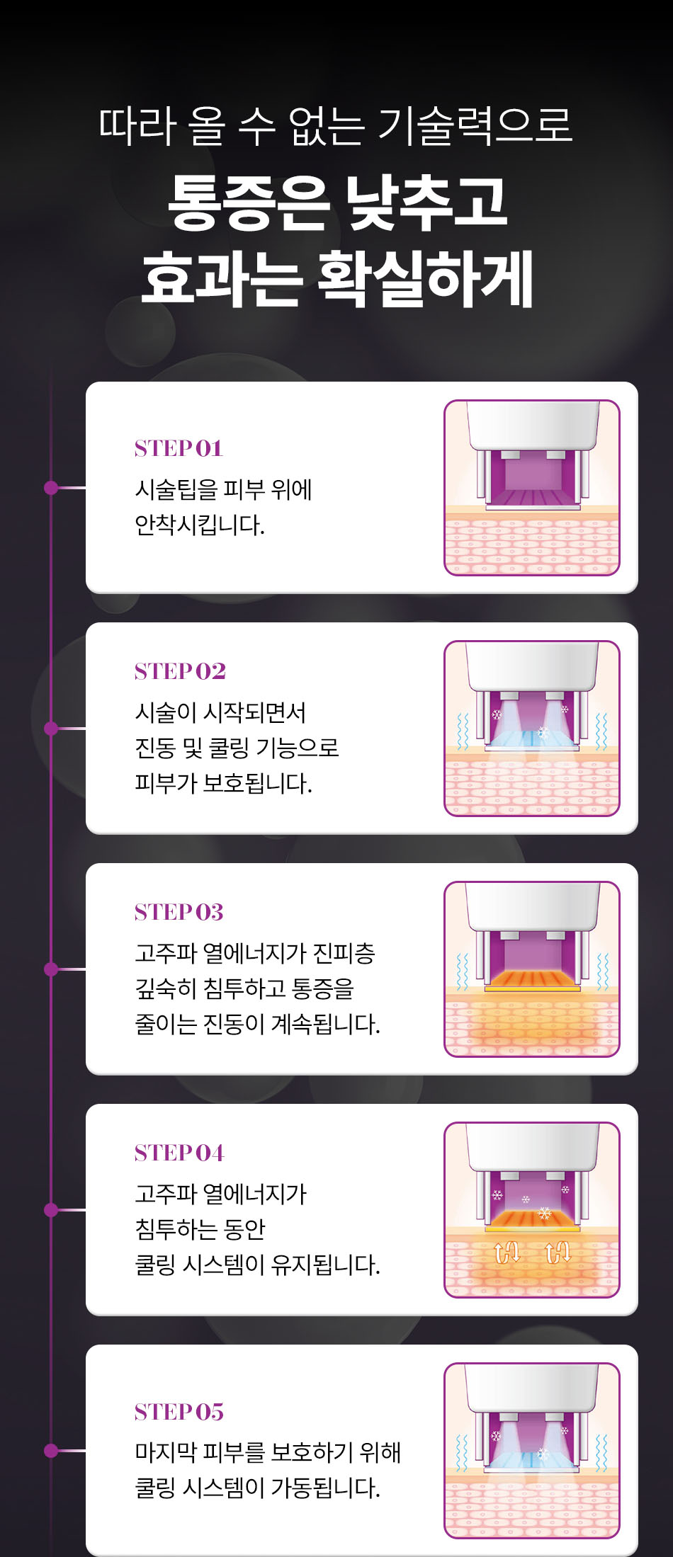 압구정 비앤미의원 써마지FLX 정품 팁 사용 인증병원 비앤미 써마지리프팅