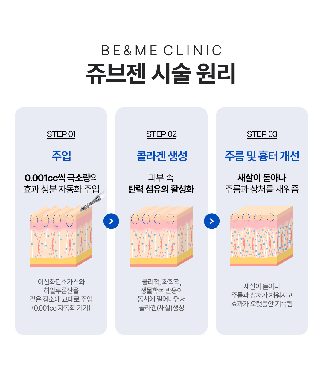 압구정 쥬브젠 팔자주름 미간주름 제거 흉터 복원 비앤미의원