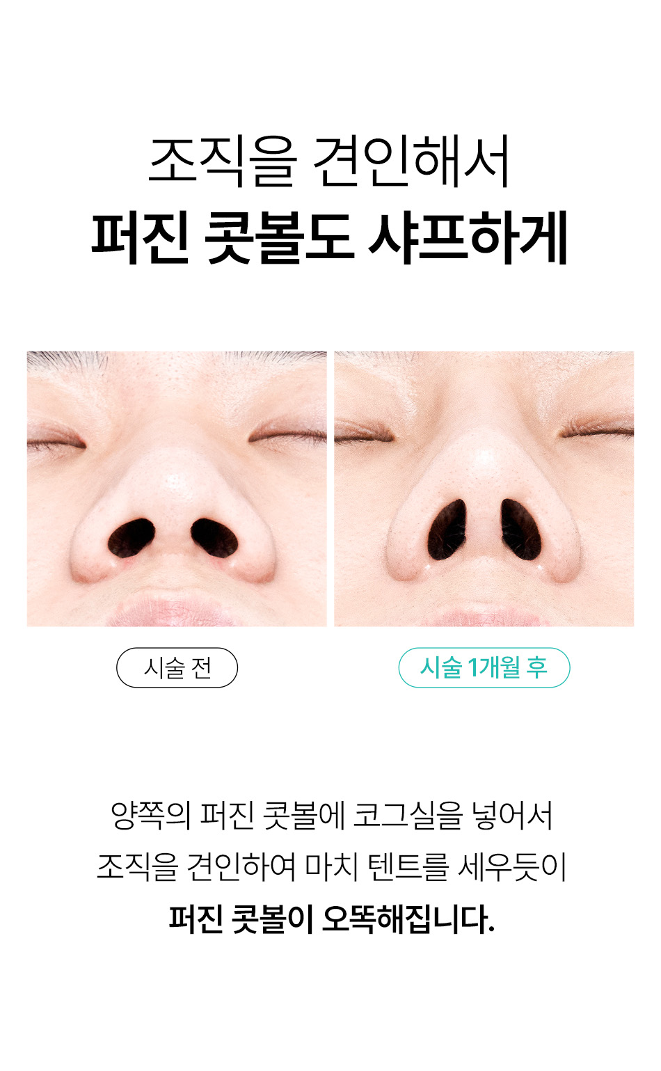 압구정 비앤미의원 압구정피부과 강남피부과 압구정성형외과 강남성형외과 강남피부과 추천 피부과 잘하는 곳 미쥬코 실 미쥬코 4줄 미쥬코 부작용 미쥬코 유지기간 미쥬코 통증 미쥬코 가격 미쥬코 후기 미쥬코 붓기 하이코유지기간 남자하이코 하이코후기 하이코실 코프팅 유지기간 코프팅 붓기 신논현 코프팅 코프팅 후기