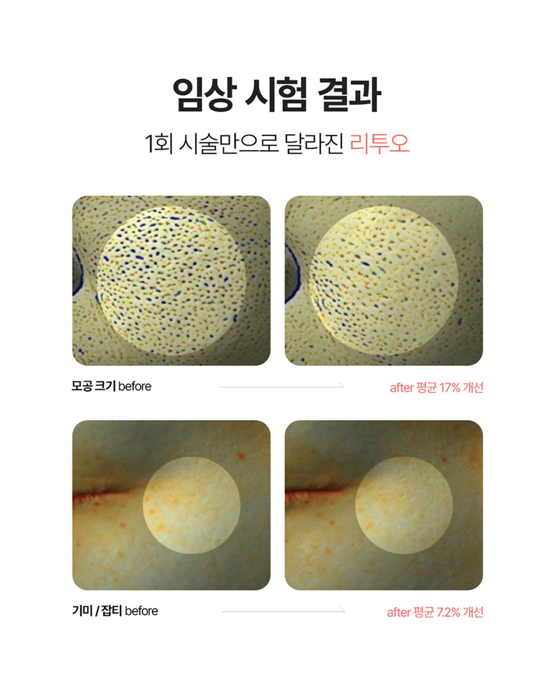 리투오 6