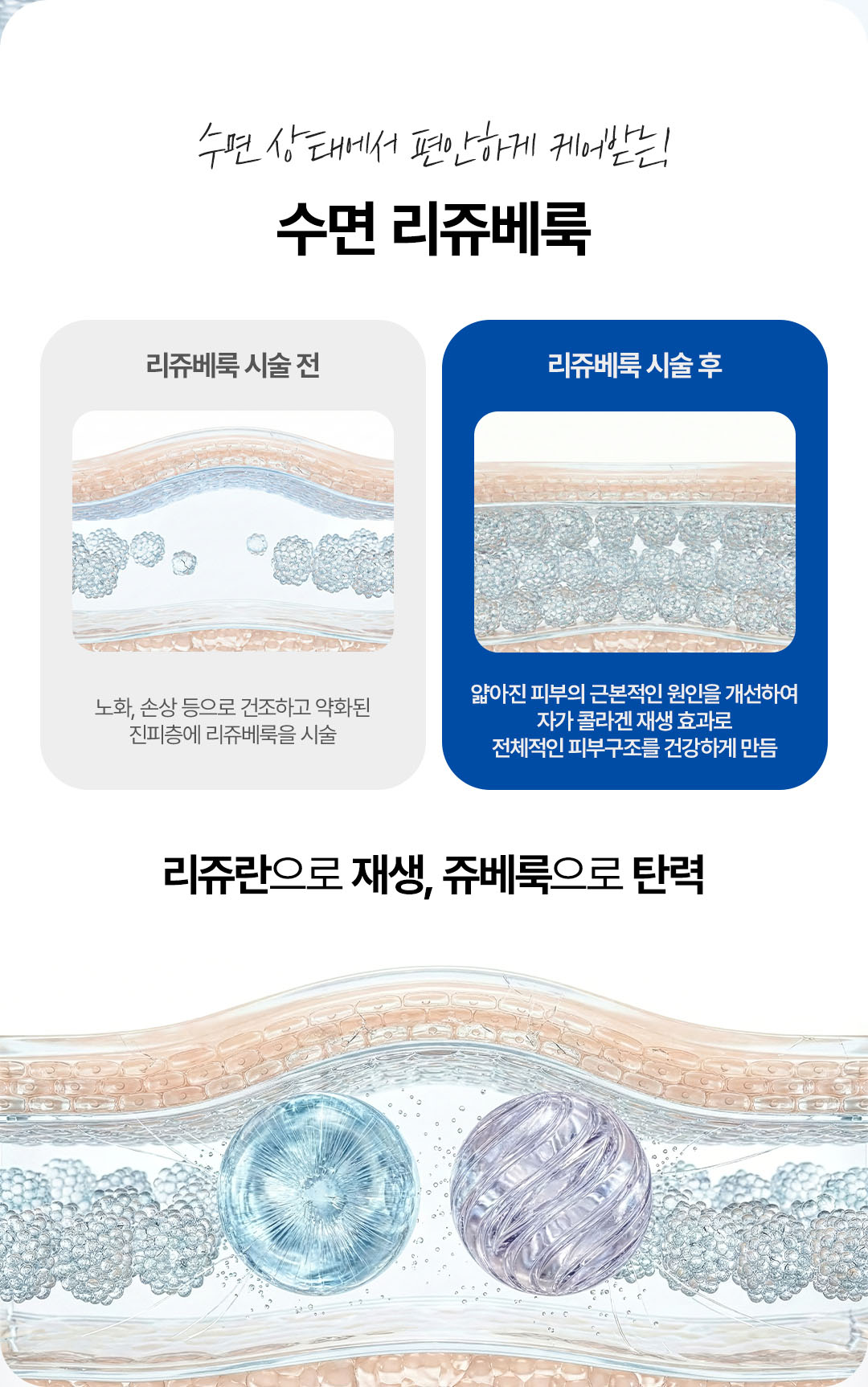 압구정 비앤미의원 리쥬베룩 효과 리쥬베룩 후기 리쥬베룩 통증 리쥬베룩 유지기간 리쥬베룩 부작용 리쥬베룩 멍  리쥬베룩 4cc 리쥬란 쥬베룩 차이 리쥬란 쥬베룩 통증 리쥬란 쥬베룩 포텐자 리쥬란 쥬베룩 효과 리쥬란 쥬베룩 스킨보톡스