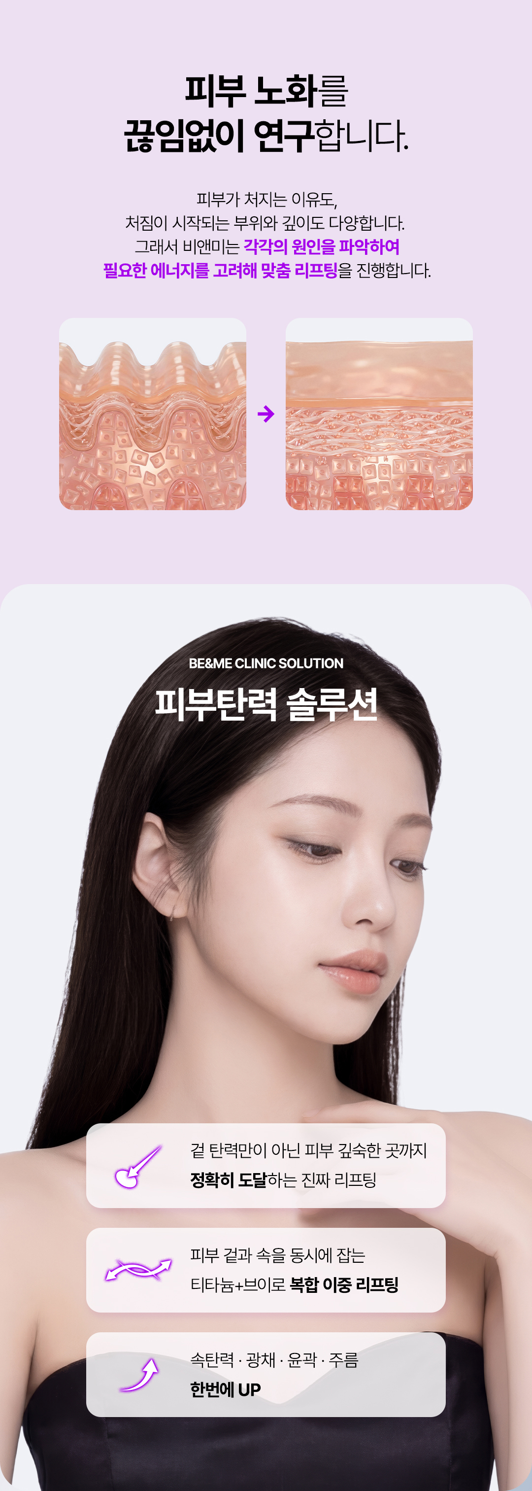 강남 얼굴라인 티타늄리프팅 브이로리프팅 복합 시술 비앤미
