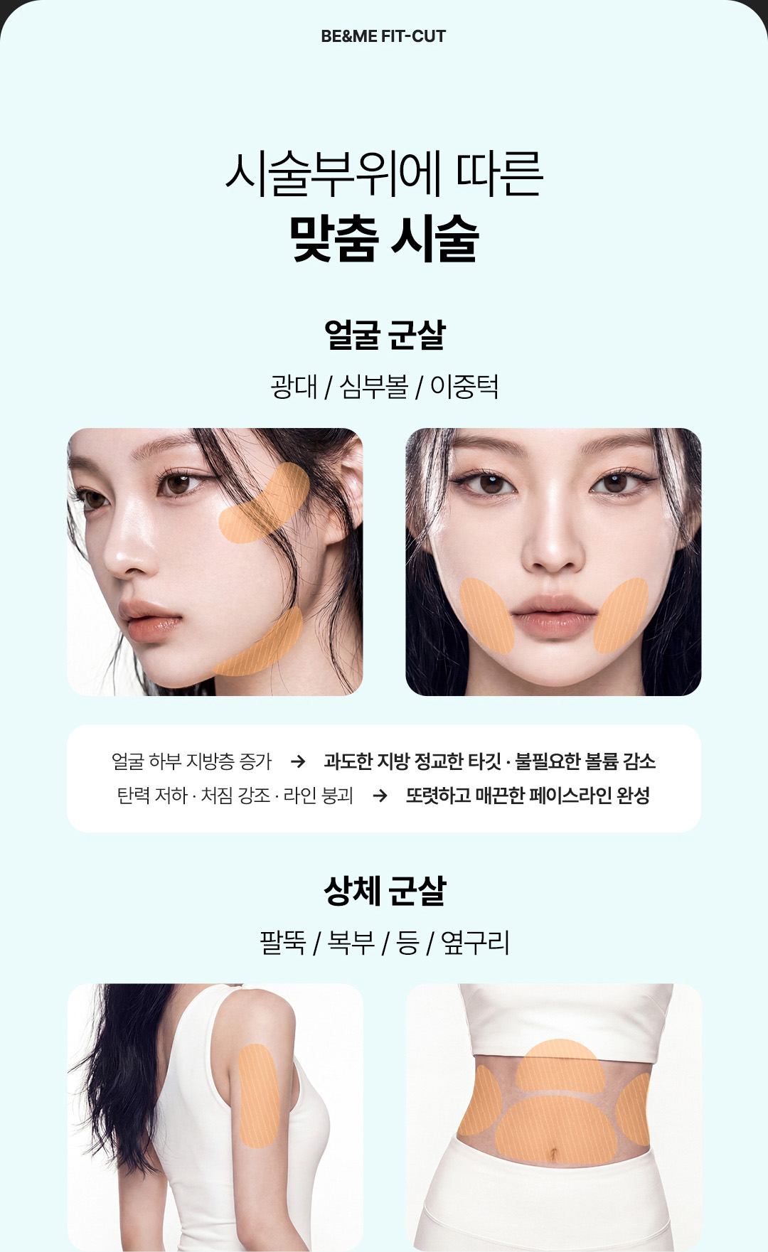 핏컷주사, 지방분해주사, 압구정 비앤미, 부위별 맞춤 시술, 얼굴 군살, 팔뚝 복부 옆구리 군살, 허벅지 엉덩이 지방 정리
