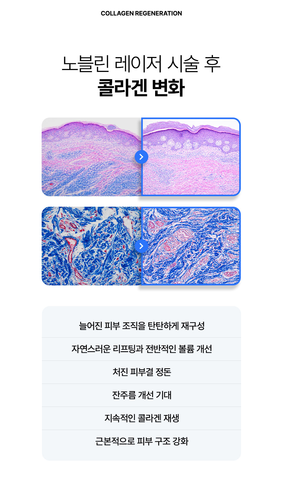 압구정 비앤미의원 자극 적은 피부 레이저 맞춤 색소 혈관 레이저 시술