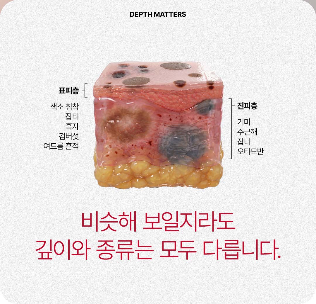 압구정 비앤미의원 압구정피부과 강남피부과 압구정성형외과 강남성형외과 서울 색소치료 서울 색소치료 가격 서울 색소치료 추천 색소치료 서울 색소치료 역삼 색소치료 강남구 강남구 색소치료 위치 강남구 색소치료 예약 강남구 색소치료 추천 피부과 잡티제거 비용 잡티제거 레이저 잡티제거 피부과 잡티제거 시술 잡티제거 비용 잡티제거 딱지 잡티제거 팩 기미제거 패치 기미제거 크림 기미제거 비용 기미제거 레이저 기미제거 팩 기미제거 시술 기미제거 가격 기미제거 피부과