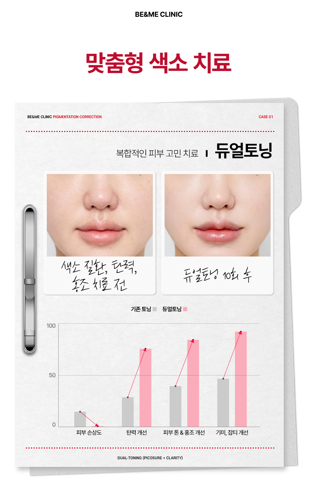 압구정 비앤미의원 압구정피부과 강남피부과 압구정성형외과 강남성형외과 서울 색소치료 서울 색소치료 가격 서울 색소치료 추천 색소치료 서울 색소치료 역삼 색소치료 강남구 강남구 색소치료 위치 강남구 색소치료 예약 강남구 색소치료 추천 피부과 잡티제거 비용 잡티제거 레이저 잡티제거 피부과 잡티제거 시술 잡티제거 비용 잡티제거 딱지 잡티제거 팩 기미제거 패치 기미제거 크림 기미제거 비용 기미제거 레이저 기미제거 팩 기미제거 시술 기미제거 가격 기미제거 피부과