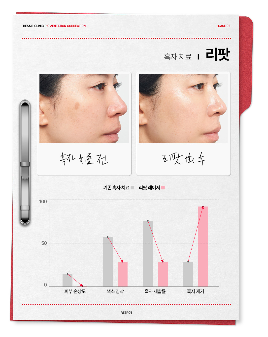 압구정 비앤미의원 압구정피부과 강남피부과 압구정성형외과 강남성형외과 서울 색소치료 서울 색소치료 가격 서울 색소치료 추천 색소치료 서울 색소치료 역삼 색소치료 강남구 강남구 색소치료 위치 강남구 색소치료 예약 강남구 색소치료 추천 피부과 잡티제거 비용 잡티제거 레이저 잡티제거 피부과 잡티제거 시술 잡티제거 비용 잡티제거 딱지 잡티제거 팩 기미제거 패치 기미제거 크림 기미제거 비용 기미제거 레이저 기미제거 팩 기미제거 시술 기미제거 가격 기미제거 피부과