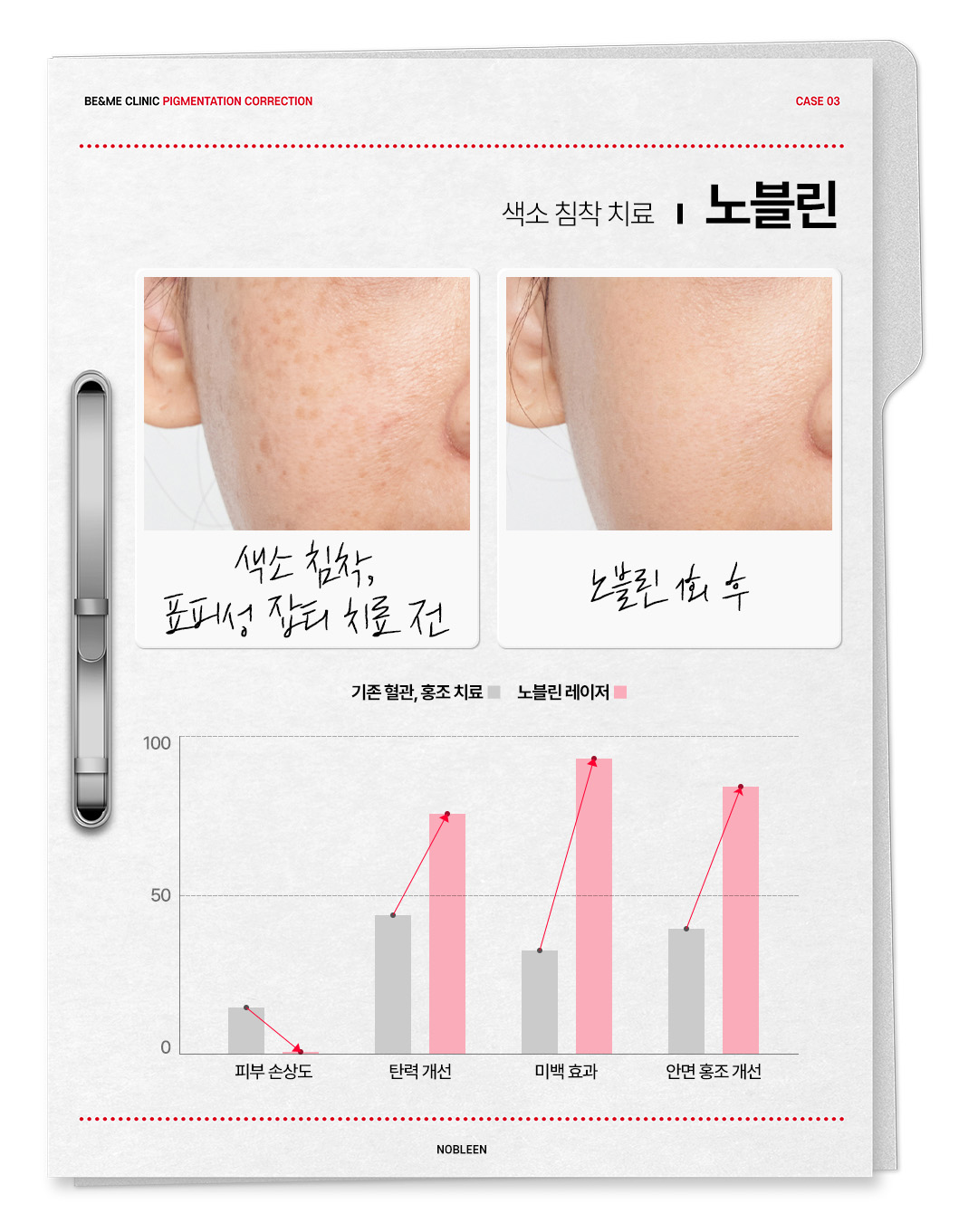 압구정 비앤미의원 압구정피부과 강남피부과 압구정성형외과 강남성형외과 서울 색소치료 서울 색소치료 가격 서울 색소치료 추천 색소치료 서울 색소치료 역삼 색소치료 강남구 강남구 색소치료 위치 강남구 색소치료 예약 강남구 색소치료 추천 피부과 잡티제거 비용 잡티제거 레이저 잡티제거 피부과 잡티제거 시술 잡티제거 비용 잡티제거 딱지 잡티제거 팩 기미제거 패치 기미제거 크림 기미제거 비용 기미제거 레이저 기미제거 팩 기미제거 시술 기미제거 가격 기미제거 피부과