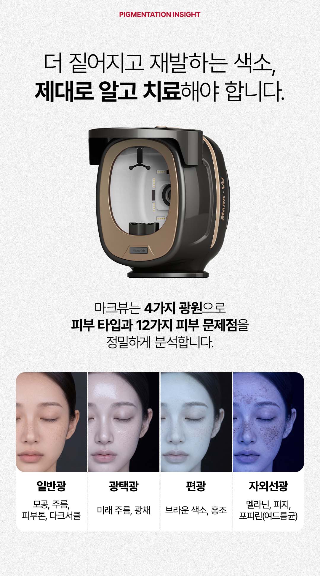 압구정 색소치료 기미 잡티부턱 흑자와 오타모반 검버섯 맞춤설계 색소치료 압구정비앤미의원