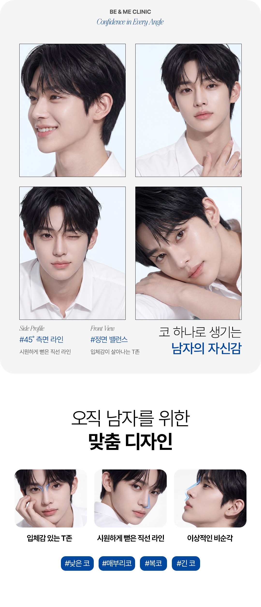 압구정 코성형, 압구정 성형외과, 압구정 비앤미, 압구정 비앤미 클리닉, 비앤미 남자 코성형, 비앤미 코성형
