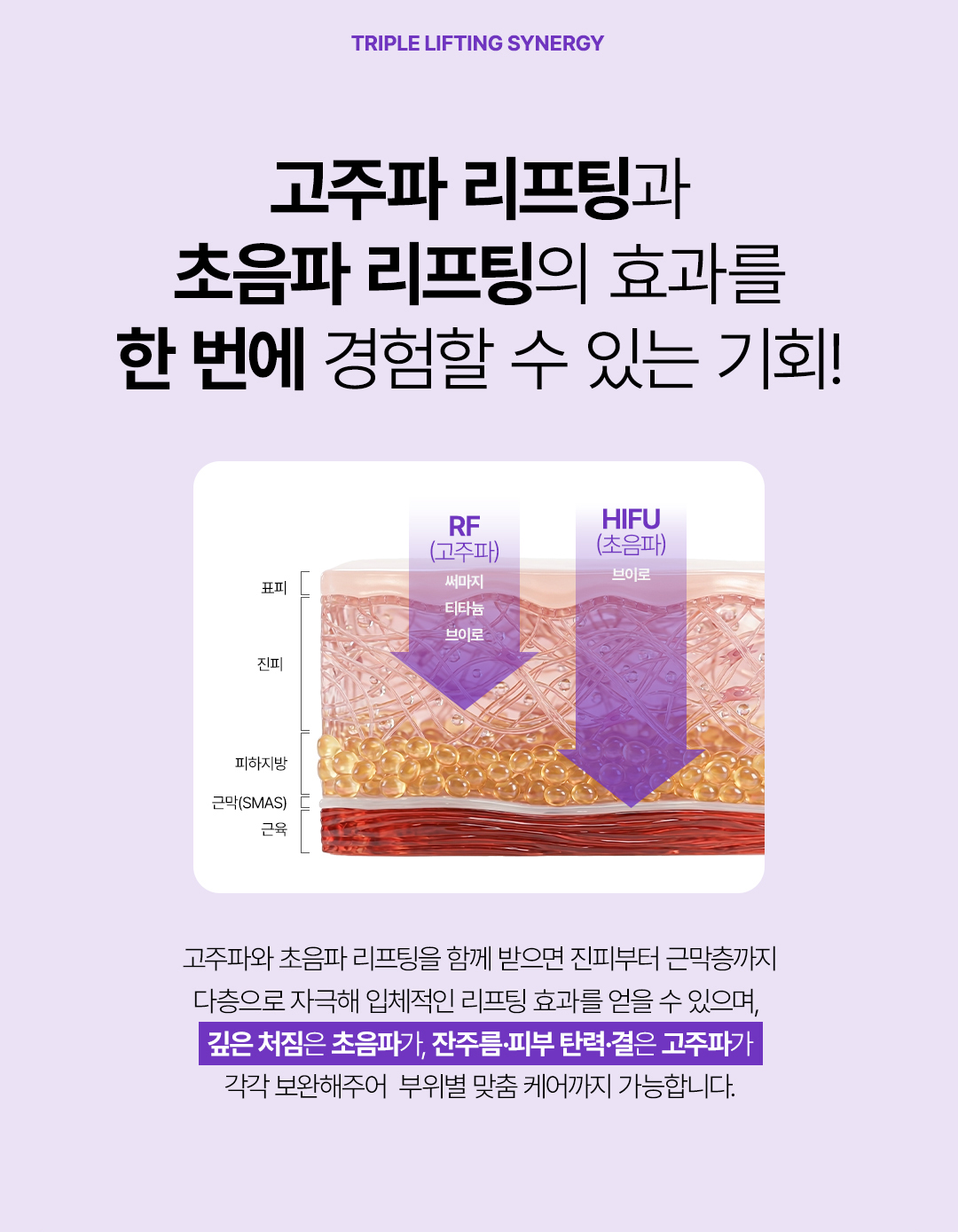 고주파와 초음파 리프팅 원리 설명 이미지. RF 고주파와 HIFU 초음파가 피부 진피층부터 SMAS층까지 다층으로 작용해 탄력과 리프팅 효과를 돕는 써브티 리프팅 구조.