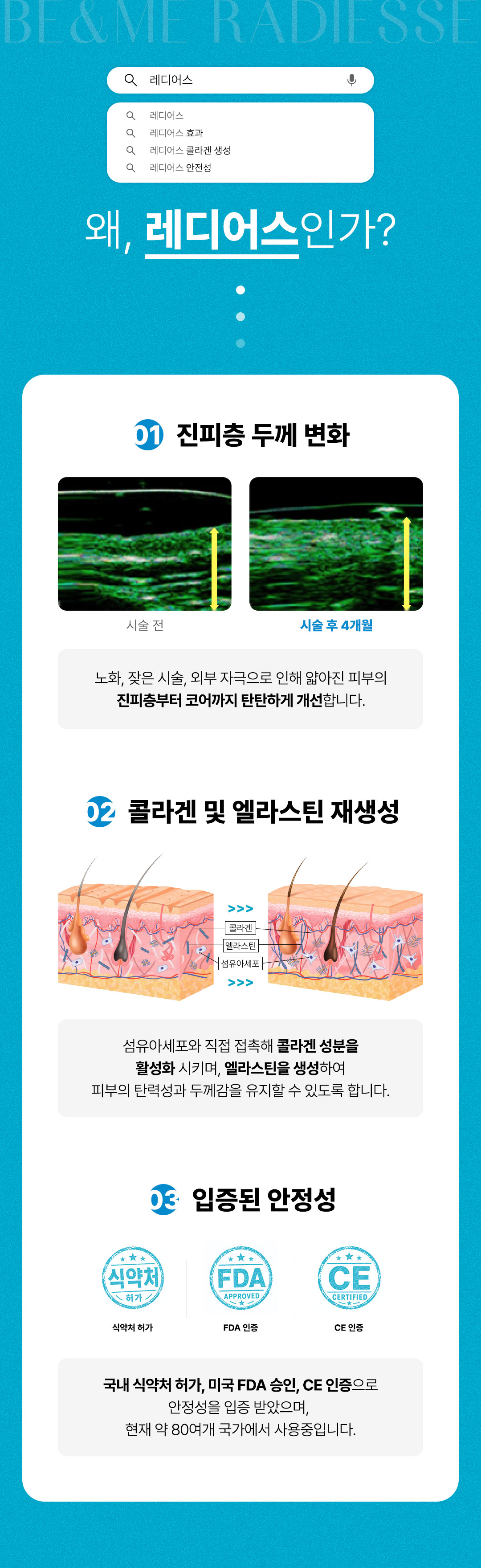 레디어스, RADIESSE, 진피층, 콜라겐, 엘라스틴, 섬유아세포, 안전성, 식약처승인, FDA승인, CE승인