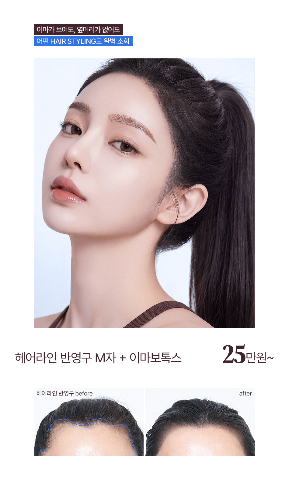 고민은 시간만 늦출뿐 2