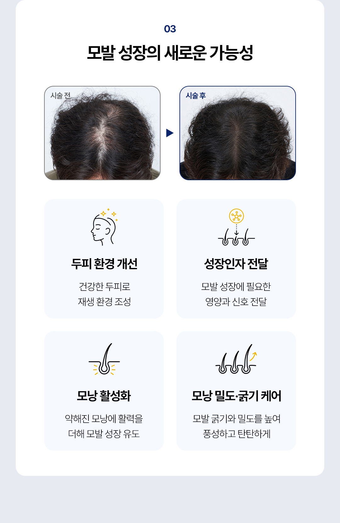 압구정 비앤미 줄기세포, 압구정 SVF 줄기세포, 압구정 피부 줄기세포, 비앤미 줄기세포, 비앤미 SVF 줄기세포, 비앤미 피부 줄기세포, SVF 줄기세포, SVF 줄기세포 시술, 피부 줄기세포, 줄기세포 시술, 줄기세포 피부재생, 줄기세포 피부탄력, 줄기세포 피부결 개선, 줄기세포 안티에이징, SVF 안티에이징, 프리미엄 줄기세포, 프리미엄 줄기세포 시술, 프리미엄 안티에이징, 피부재생 시술, 피부탄력 시술, 피부노화 관리