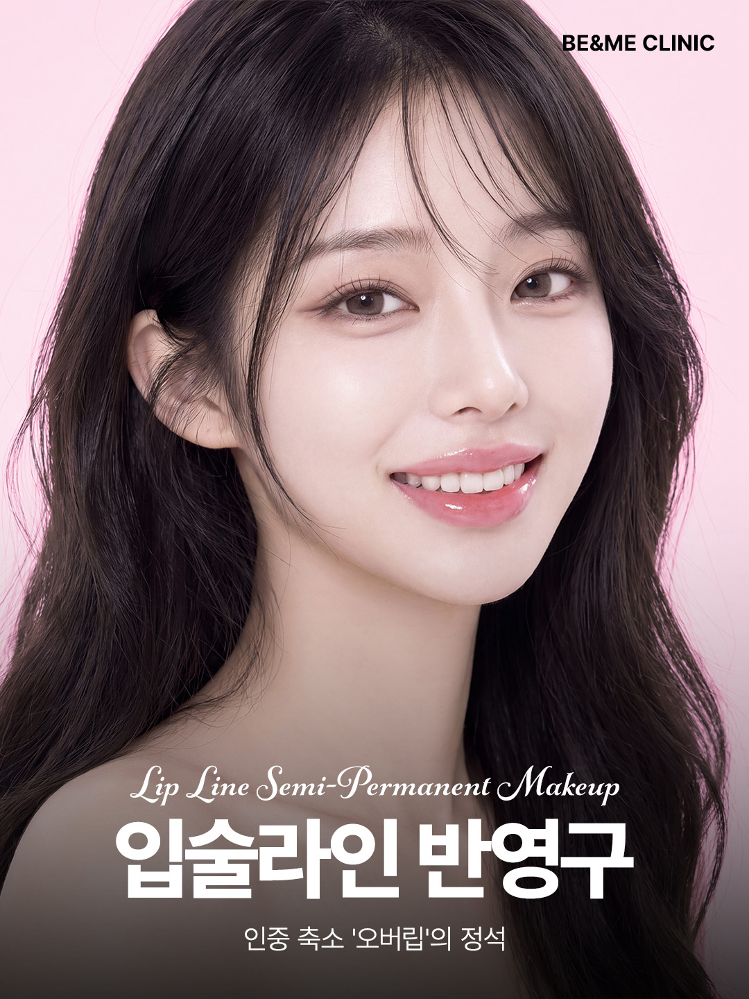 압구정 비앤미의원 입술라인 반영구 오버립 시술