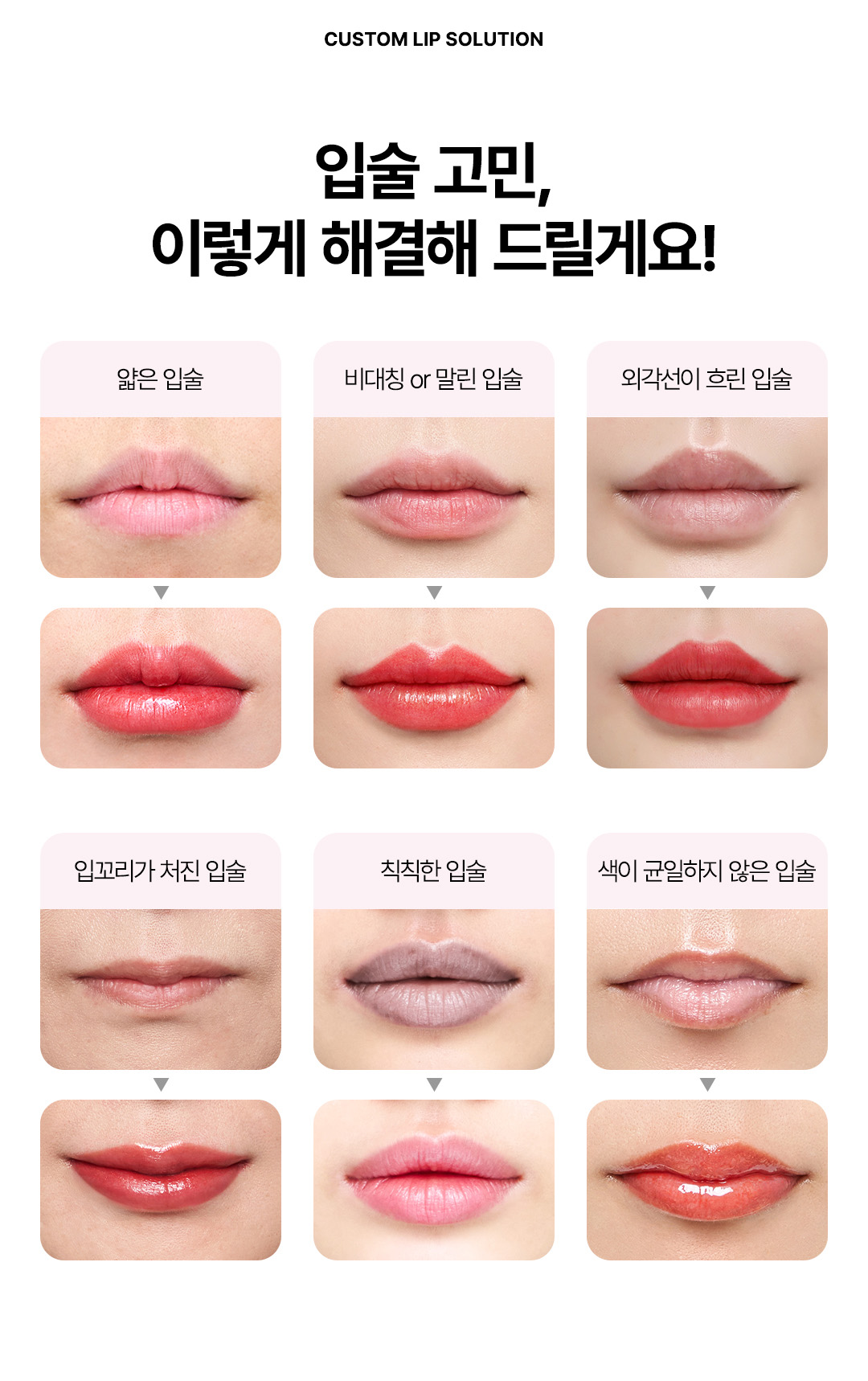 압구정 비앤미의원 입술라인 반영구 오버립