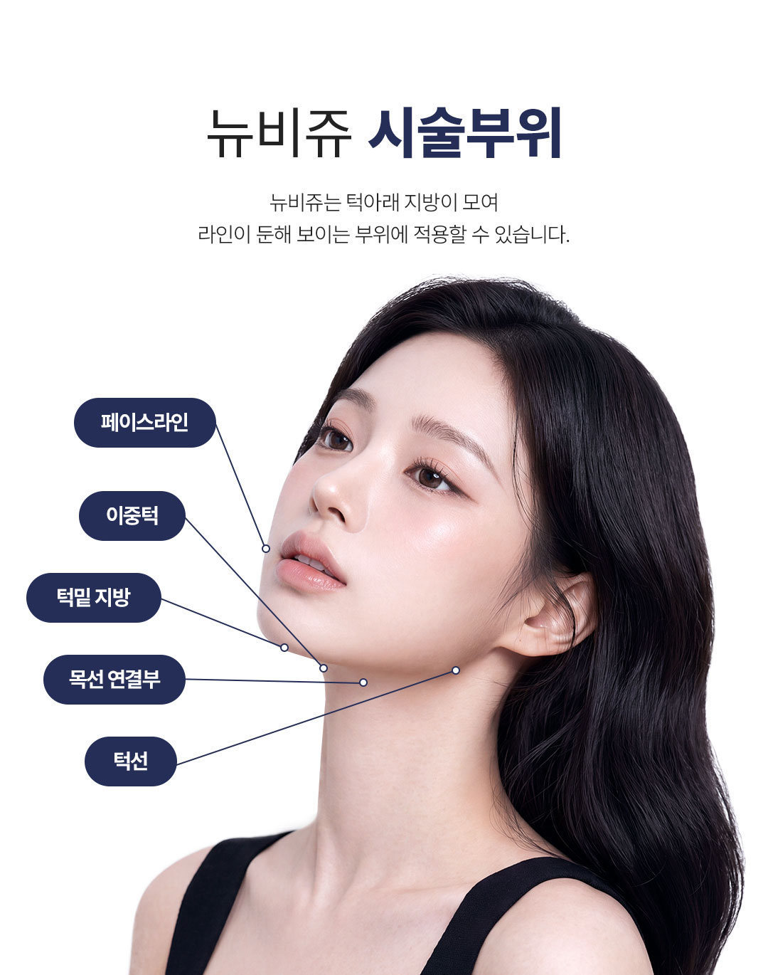 뉴비쥬 시술 추천 부위 이중턱 턱선 심부볼 윤곽 케어