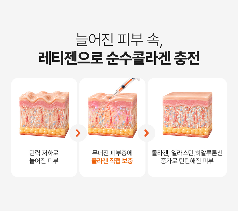 늘어진 피부 속 콜라겐 충전 레티젠 작용 원리