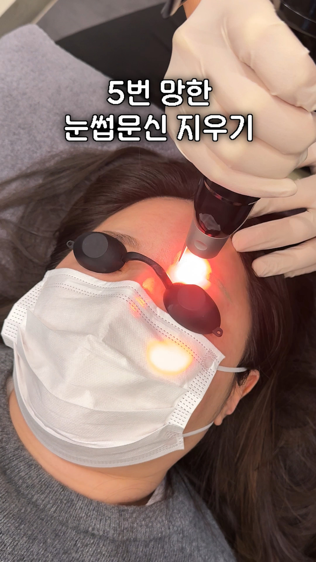 눈썹문신제거