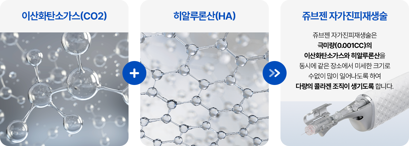 이산화탄소(CO2) + 히알루론산(HA) = 쥬브젠