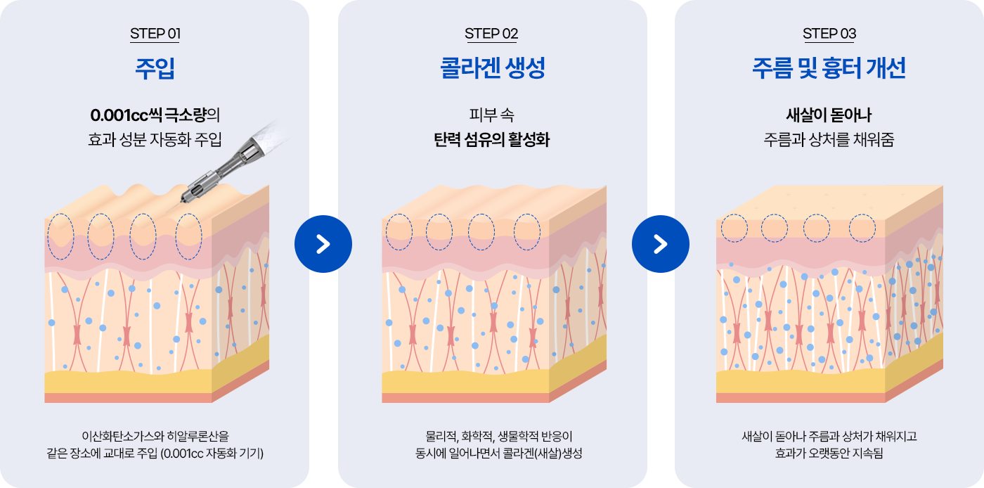 주입, 콜라겐 생성, 주름 및 흉터 개선